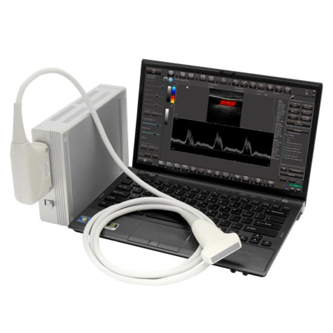 PC Based Ultrasound Medical Scanner Smartus