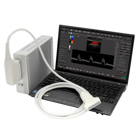 PC-BASED ULTRASOUND MEDICAL SCANNERS - SMARTUS