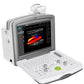 FDC6000 Full Digital Color Doppler Diagnostic System