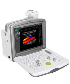 FDC6000 Full Digital Color Doppler Diagnostic System