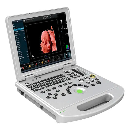 4D/5D Portable Color Doppler Ultrasound Scanner Pw-L50